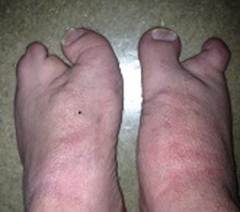 20120622161841-feet
