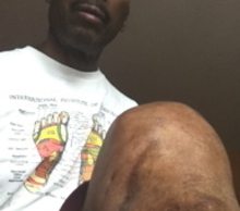 20120927074130-myknee