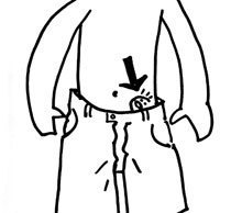 20130109230331-hernia_dwg